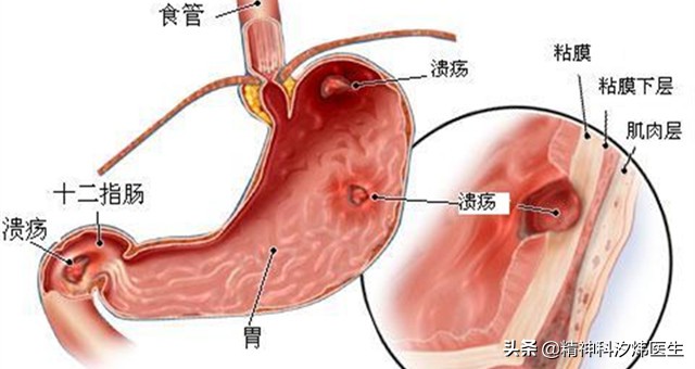 今日科普一下！3分钱1片阿司匹林,百科词条爱好_2024最新更新