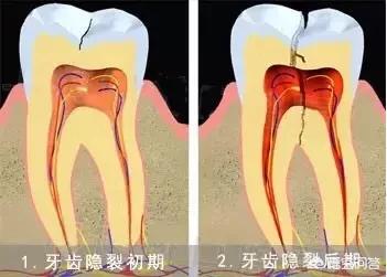 今日科普一下！喝可乐泡腐15颗牙,百科词条爱好_2024最新更新