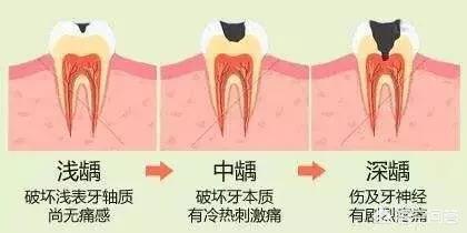 今日科普一下！喝可乐泡腐15颗牙,百科词条爱好_2024最新更新