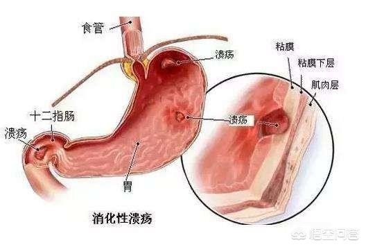 今日科普一下！车撞人群致2死68伤,百科词条爱好_2024最新更新